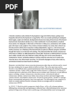 Download LEGG CALV PERTHES DISEASEss by Marjohn Omalin SN49937035 doc pdf