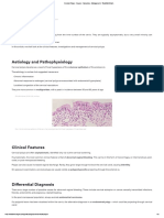 Cervical Polyps - Causes - Symptoms - Management - TeachMeObGyn