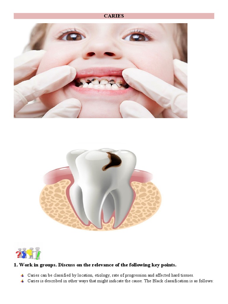 Caries 16888 | PDF | Human Tooth | Tooth Enamel