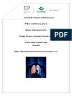 Enfermedad Pulmonar Obstructiva Crónica (EPOC): Signos, Síntomas y Tratamiento