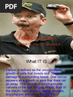 Oral Cancer: by Matt G. Dillon S. Miranda B