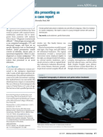 Tuberculous Peritonitis Presenting As An Acute Abdomen: A Case Report