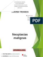 TUMORES TIROIDEOS. Neoplasias Malignas.