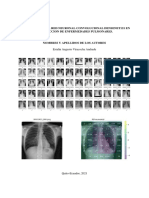 Validación Del La Red Neuronal Convolucional Densenet121 en La Deteccion de Enfermedades Pulmonares