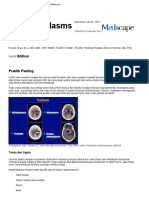 Translated Copy of Medscape Tumor Otak