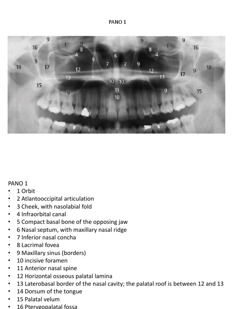 Labeled Panoramic Radiograph Landmarks | PDF