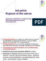 Contracted Pelvis: Rupture of The Uterus