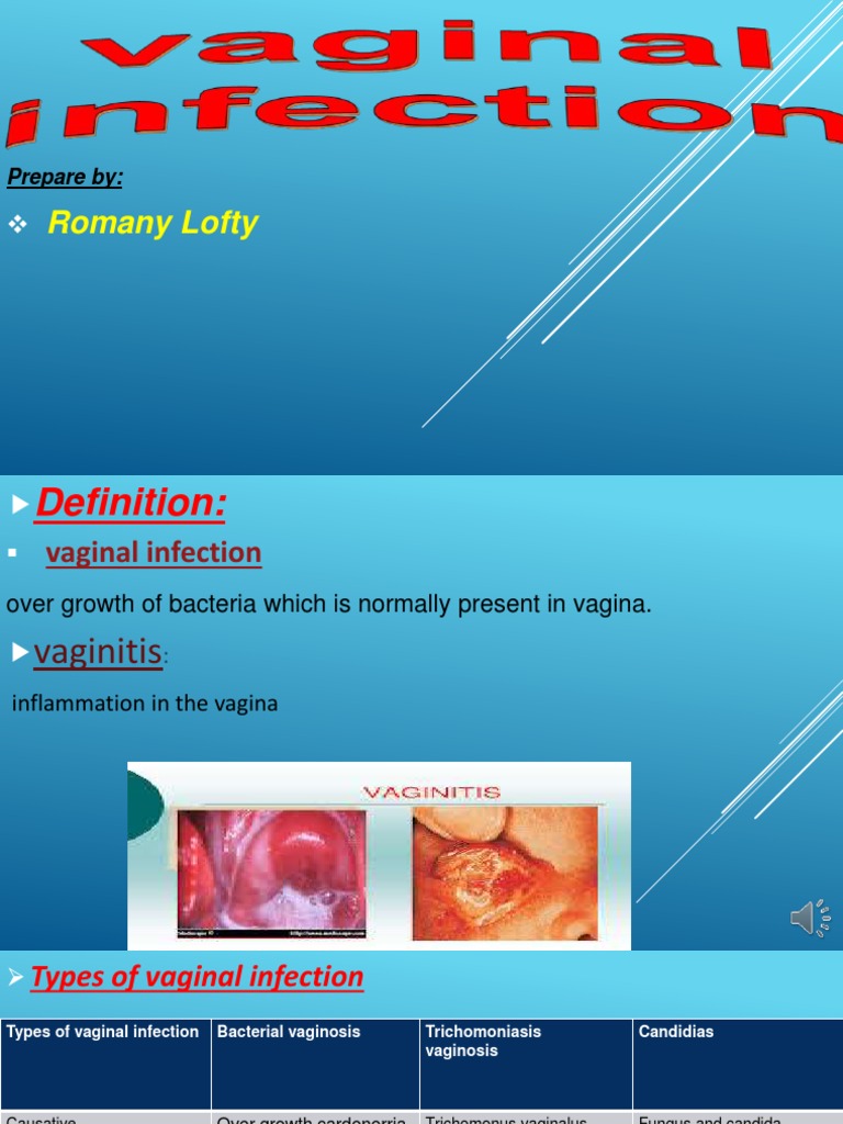 Romany Lofty: Prepare by | PDF | Vagina | Rtt