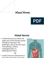 Hiatal Hernia