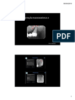 Interpretação Radiográfica Ii