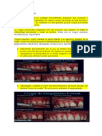 Cirugía Periodontal