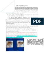 Infecciones Odontogénicas: Causas, Diseminación y Tratamiento