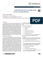 The Role of Varnish Fluoride in Preventing Tooth Decay in Young Children