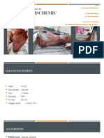 Acute Limb Ischemic (Dela Alifzya) BTKV