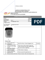 Ida Ayu Mas Harinam - Periapikal Anterior RB