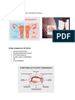 Ectopic, Preterm, PIH