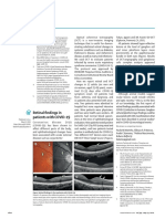 Retinal Findings in Patients COVID19
