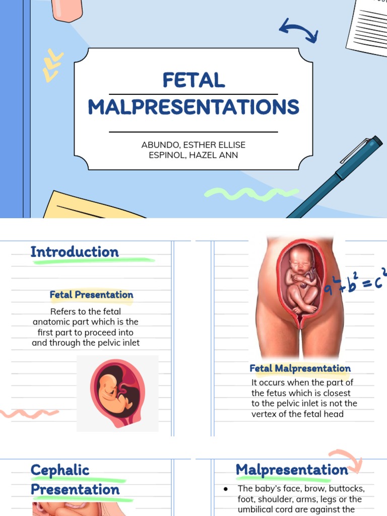 Fetal Malpresentations: Abundo, Esther Ellise Espinol, Hazel Ann | PDF ...