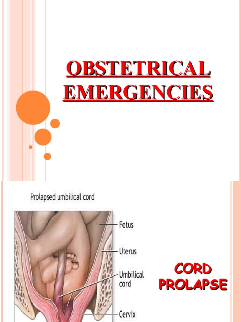 Management of Obstetric Emergencies | PDF | Shock (Circulatory ...