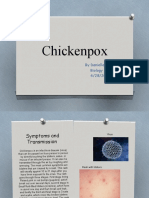 Chickenpox: by Daniella Garcia Biology 1B/4A 4/28/20