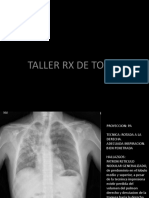 Taller Alveolar Reticular