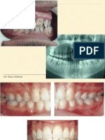 Rationale For Periodontal Treatment