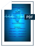 Electrocardiograma Normal