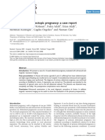 Primary Abdominal Ectopic Pregnancy: A Case Report