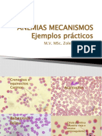 Anemias Mecanismos