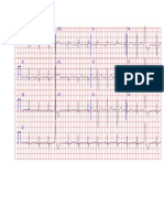 EKG 17