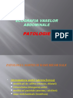 ECOGRAFIA VASELOR ABDOMINALE_patologie