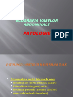Ecografia Vaselor Abdominale - Patologie