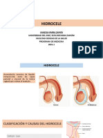 HIDROCELE