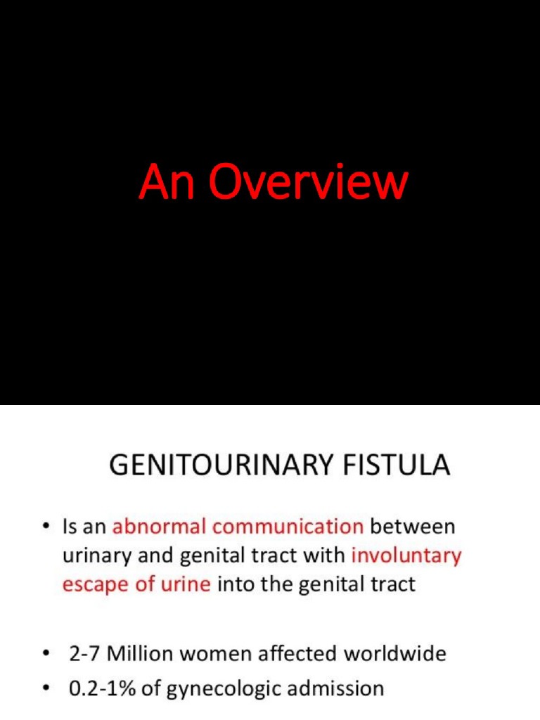 Vesico Vaginal Fistula VVF | PDF