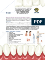 Caso Sindrome de Marfan 1