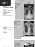 Hasil Rontgen Genu dan Cruris Normal | PDF