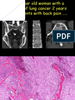 Epithelioid vascular tumors of bone and soft tissue Romania 9-28-18