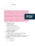 Ekg Muhammad Fasya