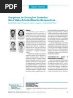 Programa de Extrações seriadas-Uma visão Ortodôntica Contemporanea