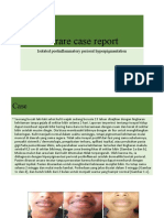 Case Postinflamatory Hyperpigmentation