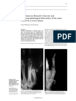 Simultaneous Bennett's Fracture and Metacarpophalangeal Dislocation of The Same Thumb in A Soccer Player