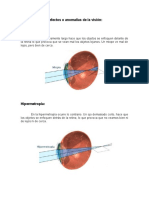 Defectos o Anomalías de La Visión