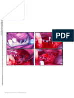 Clinical Classification of Bone Defects Concerning The Placement of Dental Implants - En.es