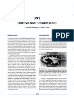 Limfoma IPD