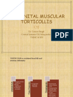 Congenital Muscular Torticolis