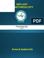 Arthroscopy Implant