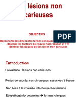 Lésions Non Carieuses Final pdf2