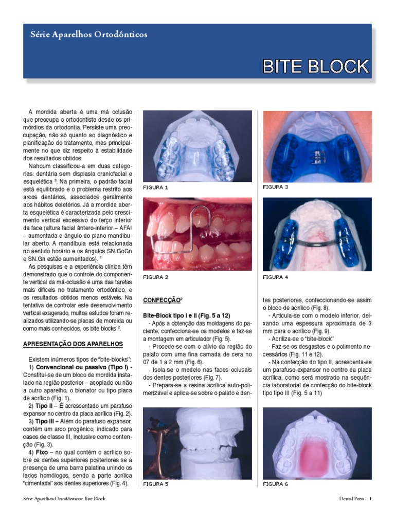Bite Block PDF Dente Ortodontia