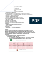 Membaca Ekg