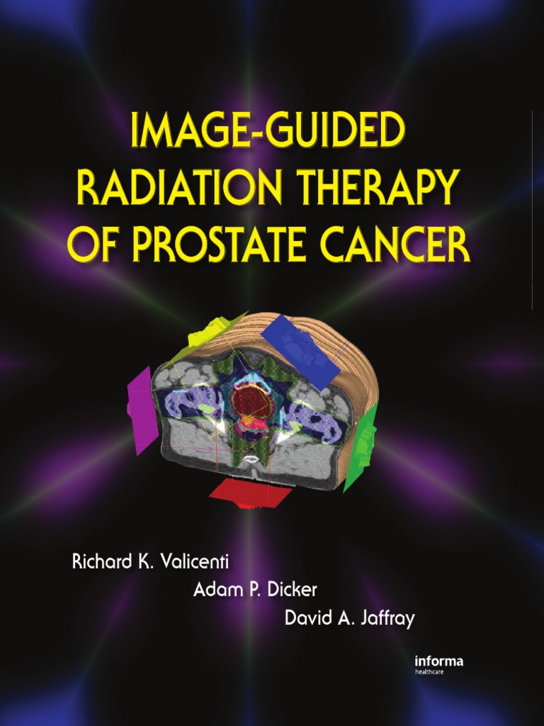 ImageGuided Radiation Therapy of Prostate Cancer | PDF | Radiation ...